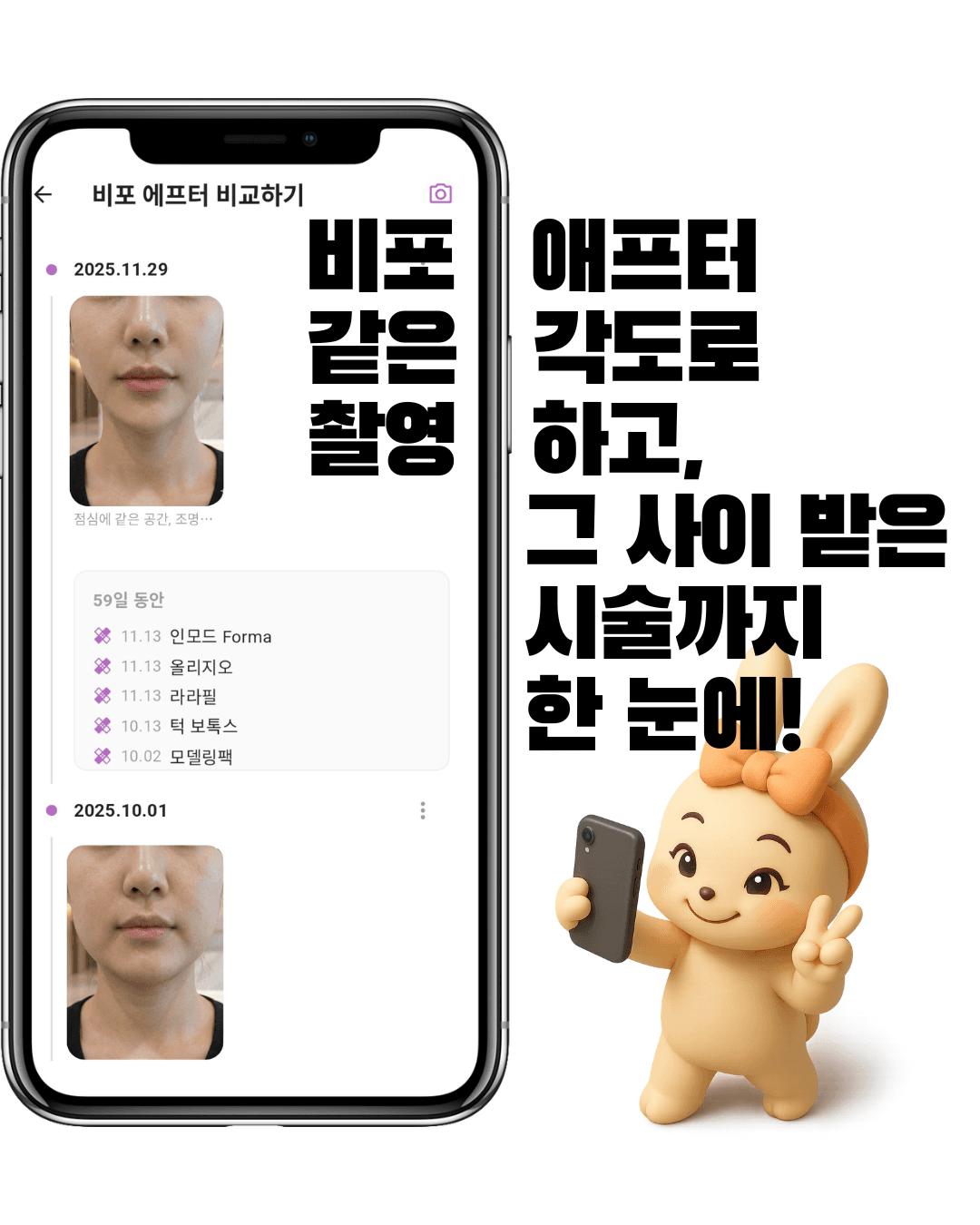 외모체크 - 시술 기록 화면